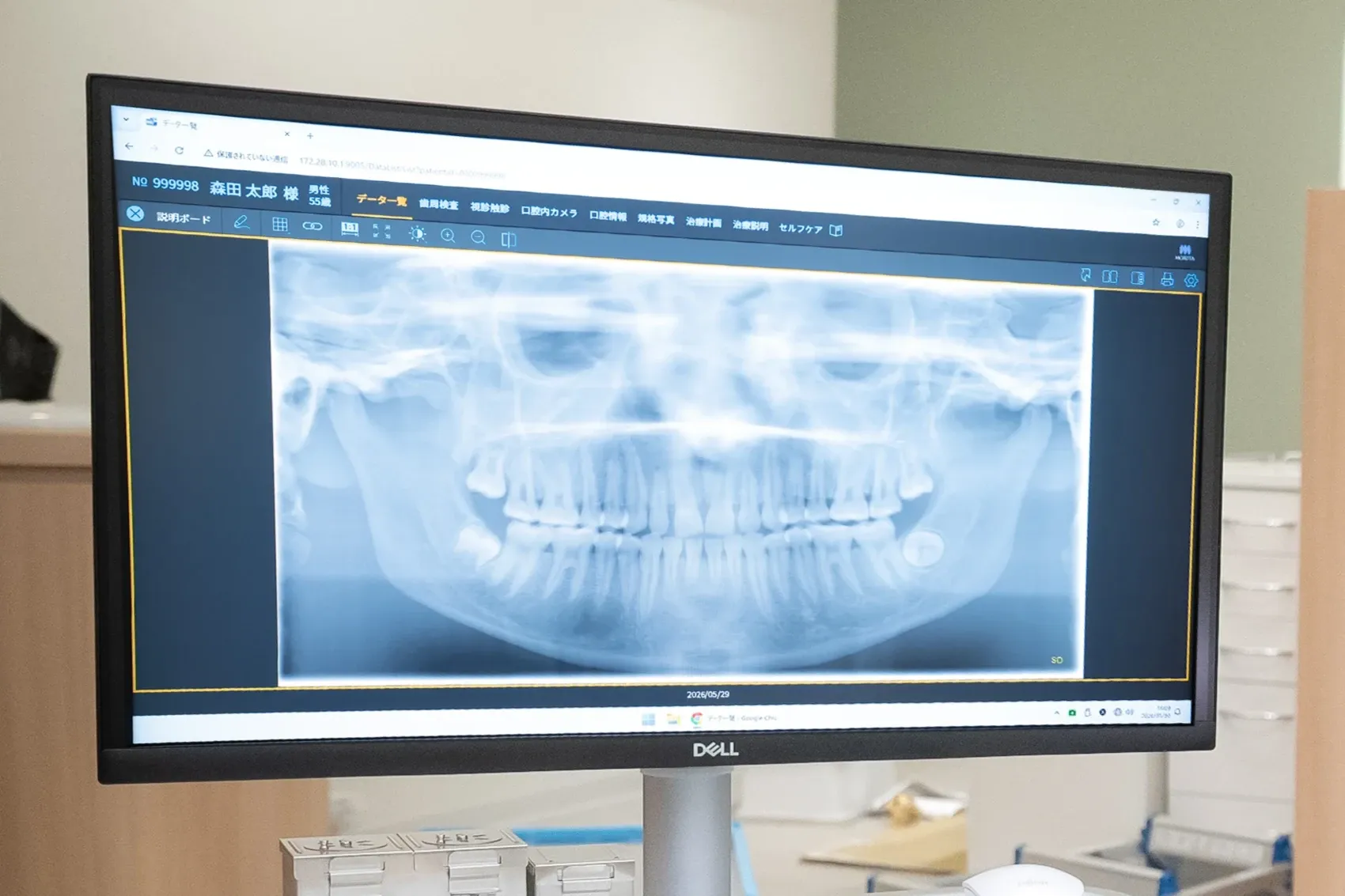 Digital X-ray Device