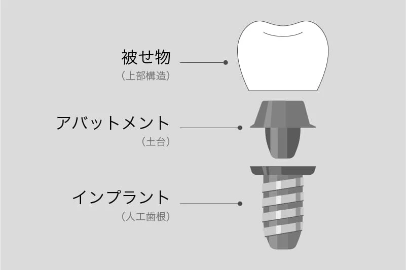 治療計画の説明・同意