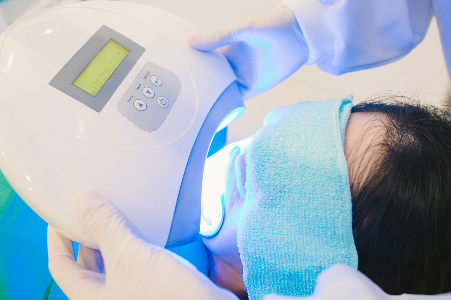 オフィスホワイトニング